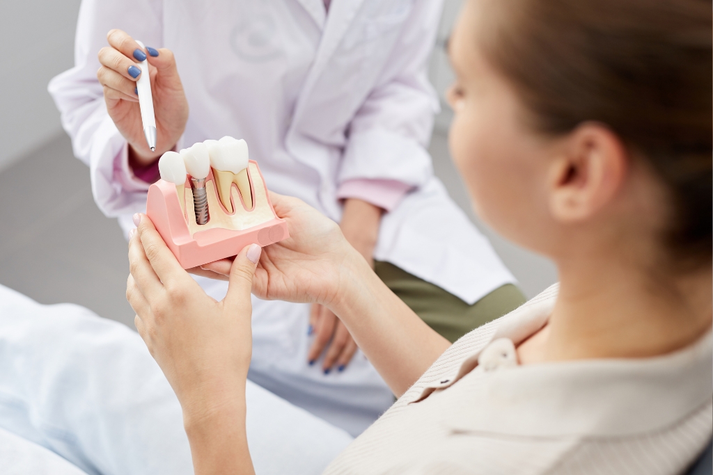 Implantes Dentários